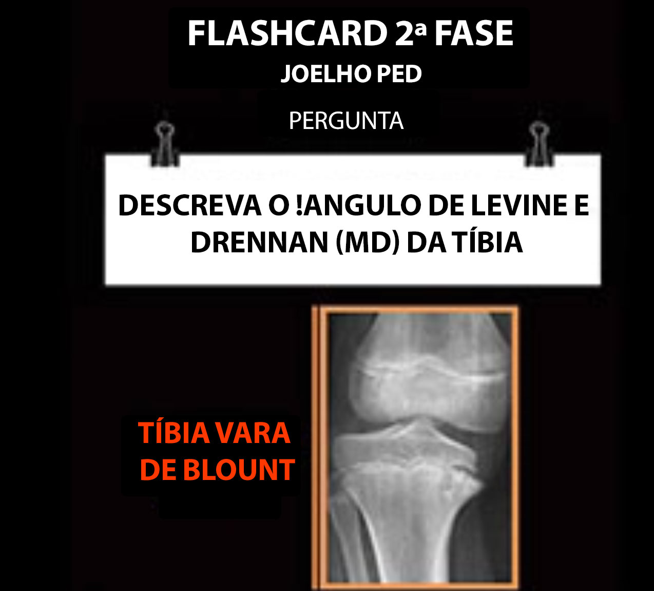 Doença de Blount no joelho pediátrico - OrtopediaOQM